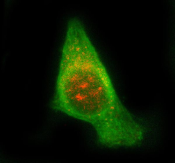 Immunofluorescent staining of STAM2 using anti-STAM2 antibody (red) and anti-Beta Tubulin antibody (green). STAM2 was detected in immunocytochemical section of PC-3 cell. Enzyme antigen retrieval was performed using IHC enzyme antigen retrieval reagent for 15 mins. The cells were blocked with 10% goat serum. And then incubated with 5 ug/ml rabbit anti-STAM2 antibody and mouse anti-Beta Tubulin antibody overnight at 4oC. Cy3 Conjugated Goat Anti-Rabbit IgG and DyLight 488 Conjugated Goat Anti-Mouse IgG were used as secondary antibody at 1:500 dilution and incubated for 30 minutes at 37oC. Visualize using a fluorescence microscope and filter sets appropriate for the label used. U2OS cells were stained with STAM2 antibody (red) and Beta-tubulin antibody (green). STAM2 displays cytoplasmic punctate staining, concentrated in the perinuclear region consistent with its association with early/sorting endosomes. The vesicular STAM2 signal partially aligns with the microtubule network, reflecting its role in endosome trafficking along microtubule tracks.