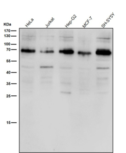 All lanes use the ACBD3 antibody at 1:1K dilution for 1 hour at room temperature. A single major band is detected just below the 70 kDa marker, consistent with the expected migration of full-length ACBD3, which typically runs above its predicted 61 kDa mass due to phosphorylation and the structured coiled-coil/GOLD domains that alter SDS-PAGE mobility. The observed band therefore represents the mature, Golgi-associated form of ACBD3.
