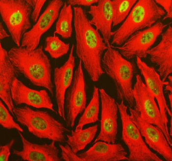 Immunohistochemical staining of TOPBP1 using anti-TOPBP1 antibody. TOPBP1 was detected in a paraffin-embedded section of rat brain tissue. Heat mediated antigen retrieval was performed in EDTA buffer (pH 8.0, epitope retrieval solution). The tissue section was blocked with 10% goat serum. The tissue section was then incubated with 2 ug/ml rabbit anti-TOPBP1 antibody overnight at 4oC. Peroxidase Conjugated Goat Anti-rabbit IgG was used as secondary antibody and incubated for 30 minutes at 37oC. The tissue section was developed using an HRP secondary and DAB substrate.