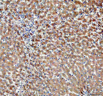 Immunohistochemical staining of PDZK1 using anti-PDZK1 antibody. PDZK1 was detected in a paraffin-embedded section of human liver tissue. Heat mediated antigen retrieval was performed in EDTA buffer (pH 8.0, epitope retrieval solution). The tissue section was blocked with 10% goat serum. The tissue section was then incubated with 2 ug/ml rabbit anti-PDZK1 antibody overnight at 4oC. Peroxidase Conjugated Goat Anti-rabbit IgG was used as secondary antibody and incubated for 30 minutes at 37oC. The tissue section was developed using an HRP secondary and DAB substrate.