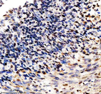 Immunohistochemical staining of SP110 using anti-SP110 antibody. SP110 was detected in a paraffin-embedded section of human tonsil tissue. Heat mediated antigen retrieval was performed in EDTA buffer (pH 8.0, epitope retrieval solution). The tissue section was blocked with 10% goat serum. The tissue section was then incubated with 2 ug/ml rabbit anti-SP110 antibody overnight at 4oC. Peroxidase Conjugated Goat Anti-rabbit IgG was used as secondary antibody and incubated for 30 minutes at 37oC. The tissue section was developed using an HRP secondary and DAB substrate.
