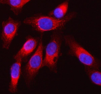 Immunofluorescent staining of SQRDL/SQOR using anti-SQOR antibody (red). SQRDL/SQOR was detected in an immunocytochemical section of PC-3 cells. Enzyme antigen retrieval was performed using IHC enzyme antigen retrieval reagent for 15 mins. The cells were blocked with 10% goat serum. And then incubated with 5 ug/ml rabbit anti-SQOR antibody overnight at 4oC. DyLight 550 Conjugated Goat Anti-Rabbit IgG was used as secondary antibody at 1:500 dilution and incubated for 30 minutes at 37oC. The section was counterstained with DAPI nuclear stain (blue). Visualize using a fluorescence microscope and filter sets appropriate for the label used.