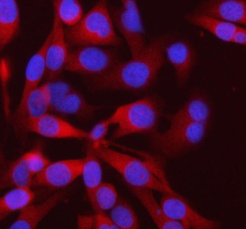 Immunofluorescent staining of FFPE human HeLa cells with PFKM antibody (red) and DAPI nuclear stain (blue). HIER: steam section in pH6 citrate buffer for 20 min.