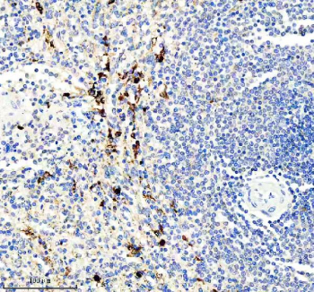 Immunohistochemical staining of IL21R using anti-IL21R antibody. IL21R was detected in a paraffin-embedded section of human spleen tissue. Heat mediated antigen retrieval was performed in EDTA buffer (pH 8.0, epitope retrieval solution). The tissue section was blocked with 10% goat serum. The tissue section was then incubated with 2 ug/ml rabbit anti-IL21R antibody overnight at 4oC. Peroxidase Conjugated Goat Anti-rabbit IgG was used as secondary antibody and incubated for 30 minutes at 37oC. The tissue section was developed using an HRP secondary and DAB substrate.