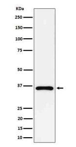 Western blot analysis of GAS2 expression in human Jurkat cell lysate using GAS2 antibody. Predicted molecular weight ~35 kDa.