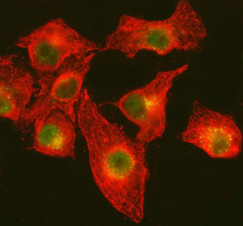 Immunofluorescent staining of DNA Ligase IV/LIG4 using anti-LIG4 antibody (green) and anti-Tubulin Alpha antibody (red). DNA Ligase IV/LIG4 was detected in immunocytochemical section of cell. Enzyme antigen retrieval was performed using IHC enzyme antigen retrieval reagent for 15 mins. The cells were blocked with 10% goat serum. And then incubated with 5 ug/ml rabbit anti-DNA Ligase IV/LIG4 antibody and mouse anti-Tubulin Alpha antibody overnight at 4oC. Cy3 Conjugated Goat Anti-Rabbit IgG and DyLight 488 Conjugated Goat Anti-Mouse IgG were used as secondary antibody at 1:500 dilution and incubated for 30 minutes at 37oC. Visualize using a fluorescence microscope and filter sets appropriate for the label used.