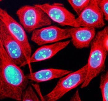 Immunofluorescent staining of TCOF1 using anti-TCOF1 antibody (green) and anti-Beta Tubulin antibody (red). TCOF1 was detected in an immunocytochemical section of human SIHA cells. Enzyme antigen retrieval was performed using IHC enzyme antigen retrieval reagent for 15 mins. The cells were blocked with 10% goat serum. And then incubated with 5 ug/ml rabbit anti-TCOF1 antibody and mouse anti-Beta Tubulin antibody overnight at 4oC. DyLight 488 Conjugated Goat Anti-Rabbit IgG and Cy3 Conjugated Goat Anti-Mouse IgG were used as secondary antibody at 1:500 dilution and incubated for 30 minutes at 37oC. The section was counterstained with DAPI nuclear stain (blue). Visualize using a fluorescence microscope and filter sets appropriate for the label used.