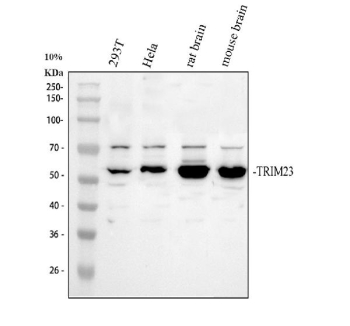 Western blot analysis of TRIM23 using anti-TRIM23 antibody. Electrophoresis was performed on a 10% SDS-PAGE gel at 80V (Stacking gel) / 120V (Resolving gel) for 2 hours. Lane 1: human 293T whole cell lysates, Lane 2: human Hela whole cell lysates, Lane 3: rat brain tissue lysates, Lane 4: mouse brain tissue lysates. After electrophoresis, proteins were transferred to a nitrocellulose membrane at 150 mA for 50-90 minutes. Blocked the membrane with 5% non-fat milk/TBS for 1.5 hour at RT. The membrane was incubated with rabbit anti-TRIM23 antibody at 0.5 ug/ml overnight at 4oC, then washed with TBS-0.1%Tween 3 times with 5 minutes each and probed with a goat anti-rabbit IgG-HRP secondary antibody at a dilution of 1:5000 for 1.5 hour at RT. The signal was developed using an ECL Plus Western Blotting Substrate. TRIM23 antibody detects a dominant band at ~55 kDa with a weaker band at ~70 kDa across 293T, HeLa, and rodent brain lysates. Although the predicted size is ~64 kDa, TRIM23 commonly appears as a paired signal due to post-translational modification. The upper band is consistent with mono-ubiquitinated or hyperphosphorylated TRIM23, while the lower band likely represents a dephosphorylated or truncated form.
