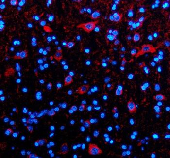 Immunofluorescent staining of TIM10/TIMM10 using anti-TIMM10 antibody (red). TIM10/TIMM10 was detected in a paraffin-embedded section of rat brain tissue. Heat mediated antigen retrieval was performed in EDTA buffer (pH 8.0, epitope retrieval solution). The tissue section was blocked with 10% goat serum. The tissue section was then incubated with 5 ug/ml rabbit anti-TIMM10 antibody overnight at 4oC. Cy3 Conjugated Goat Anti-Rabbit IgG was used as secondary antibody at 1:500 dilution and incubated for 30 minutes at 37oC. The section was counterstained with DAPI nuclear stain (blue). Visualize using a fluorescence microscope and filter sets appropriate for the label used.