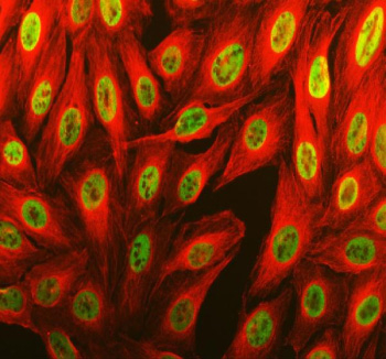 Immunofluorescent staining of THRAP3 using anti-THRAP3 antibody (green) and anti-Alpha Tubulin antibody (red). THRAP3 was detected in an immunocytochemical section of U2OS cells. Enzyme antigen retrieval was performed using IHC enzyme antigen retrieval reagent for 15 mins. The cells were blocked with 10% goat serum. And then incubated with 5 ug/ml rabbit anti-THRAP3 antibody and mouse anti-Beta Tubulin antibody overnight at 4oC. DyLight 488 Conjugated Goat Anti-Rabbit IgG and Cy3 Conjugated Goat Anti-Mouse IgG were used as secondary antibody at 1:500 dilution and incubated for 30 minutes at 37oC. Visualize using a fluorescence microscope and filter sets appropriate for the label used.