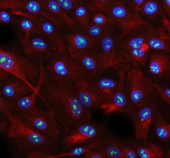 Immunofluorescent staining of AATF using anti-AATF antibody (green) and anti-Beta Tubulin antibody (red). AATF was detected in immunocytochemical section of cell. Enzyme antigen retrieval was performed using IHC enzyme antigen retrieval reagent for 15 mins. The cells were blocked with 10% goat serum. And then incubated with 5 ug/ml rabbit anti-AATF antibody and mouse anti-Beta Tubulin antibody overnight at 4oC. DyLight 488 Conjugated Goat Anti-Rabbit IgG and Cy3 Conjugated Goat Anti-Mouse IgG were used as secondary antibody at 1:500 dilution and incubated for 30 minutes at 37oC. The section was counterstained with DAPI nuclear stain (blue). Visualize using a fluorescence microscope and filter sets appropriate for the label used.