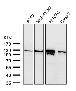 Western blot testing of human samples using the PALLD antibody at 1:3000 dilution for 1 hour at room temperature. PALLD antibody detects a band migrating at ~125-135 kDa in the indicated cell lysates, consistent with the 140-kDa Palladin isoform. Minor gel-to-gel variation reflects phosphorylation-dependent mobility and cytoskeletal protein behavior. Lower fragments (when present) are attributed to regulated proteolysis.
