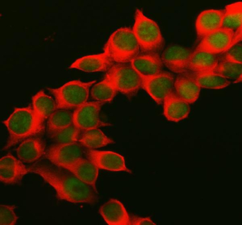 Immunofluorescent staining of MEPCE using anti-MEPCE antibody (green) and anti-Beta Tubulin antibody (red). MEPCE was detected in an immunocytochemical section of MCF-7 cells. Enzyme antigen retrieval was performed using IHC enzyme antigen retrieval reagent for 15 mins. The cells were blocked with 10% goat serum. And then incubated with 5 ug/ml rabbit anti-MEPCE antibody and mouse anti-Beta Tubulin antibody overnight at 4oC. DyLight 488 Conjugated Goat Anti-Rabbit IgG and Cy3 Conjugated Goat Anti-Mouse IgG were used as secondary antibody at 1:500 dilution and incubated for 30 minutes at 37oC. Visualize using a fluorescence microscope and filter sets appropriate for the label used.