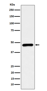 Western blot analysis of CECR5/HDHD5 expression in HepG2 cell lysate using HDHD5 antibody. Predicted molecular weight ~46 kDa.