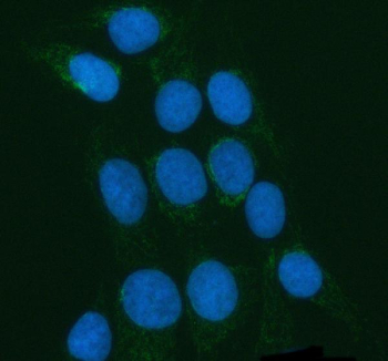 Immunofluorescent staining of POLDIP2 using anti-POLDIP2 antibody (green). POLDIP2 was detected in an immunocytochemical section of U2OS cells. Enzyme antigen retrieval was performed using IHC enzyme antigen retrieval reagent for 15 mins. The cells were blocked with 10% goat serum. And then incubated with 5 ug/ml rabbit anti-POLDIP2 antibody overnight at 4oC. DyLight 488 Conjugated Goat Anti-Rabbit IgG was used as secondary antibody at 1:500 dilution and incubated for 30 minutes at 37oC. The section was counterstained with DAPI nuclear stain (blue). Visualize using a fluorescence microscope and filter sets appropriate for the label used.