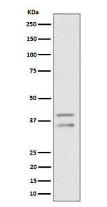 Western blot analysis of UFD1L expression in human HeLa cell lysate using UFD1L antibody. UFD1L antibody detects two bands at ~35 kDa and ~38-40 kDa, consistent with hypo- and hyper-phosphorylated forms of UFD1.