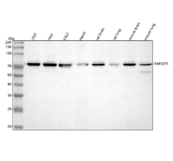 Western blot analysis of RAPGEF5 using anti-RAPGEF5 antibody. Lane 1: human 293T whole cell lysates, Lane 2: human Hela whole cell lysates, Lane 3: human K562 whole cell lysates, Lane 4: human Hacat whole cell lysates, Lane 5: rat brain tissue lysates, Lane 6: rat lung tissue lysates, Lane 7: mouse brain tissue lysates, Lane 8: mouse lung tissue lysates. After electrophoresis, proteins were transferred to a nitrocellulose membrane at 150 mA for 50-90 minutes. Blocked the membrane with 5% non-fat milk/TBS for 1.5 hour at RT. The membrane was incubated with rabbit anti-RAPGEF5 antibody at 0.5 ug/ml overnight at 4oC, then washed with TBS-0.1%Tween 3 times with 5 minutes each and probed with a goat anti-rabbit IgG-HRP secondary antibody at a dilution of 1:5000 for 1.5 hour at RT. The signal was developed using enhanced chemiluminescent. Western blot of RAPGEF5 shows a single band in the low-70s kDa range, consistent with the expected size (~68 kDa) and the known tendency of RAPGEF5 to migrate slightly larger on SDS-PAGE.
