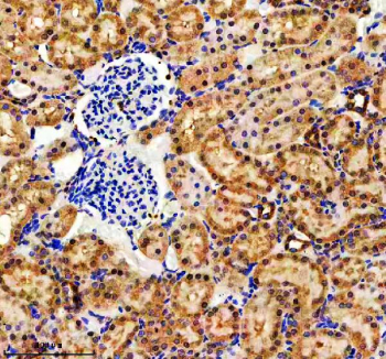 Immunohistochemical staining of EVC2 using anti-EVC2 antibody. EVC2 was detected in a paraffin-embedded section of rat kidney tissue. Heat mediated antigen retrieval was performed in EDTA buffer (pH 8.0, epitope retrieval solution). The tissue section was blocked with 10% goat serum. The tissue section was then incubated with 2 ug/ml rabbit anti-EVC2 antibody overnight at 4oC. Peroxidase Conjugated Goat Anti-rabbit IgG was used as secondary antibody and incubated for 30 minutes at 37oC. The tissue section was developed using an HRP secondary and DAB substrate.