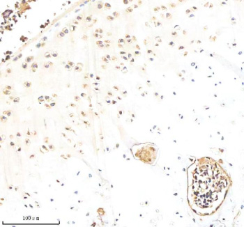 Immunohistochemical staining of Biglycan/BGN using anti-BGN antibody. Biglycan/BGN was detected in a paraffin-embedded section of rat knee tissue. Heat mediated antigen retrieval was performed in EDTA buffer (pH 8.0, epitope retrieval solution). The tissue section was blocked with 10% goat serum. The tissue section was then incubated with 2 ug/ml rabbit anti-BGN antibody overnight at 4oC. Peroxidase Conjugated Goat Anti-rabbit IgG was used as secondary antibody and incubated for 30 minutes at 37oC. The tissue section was developed using an HRP secondary and DAB substrate.