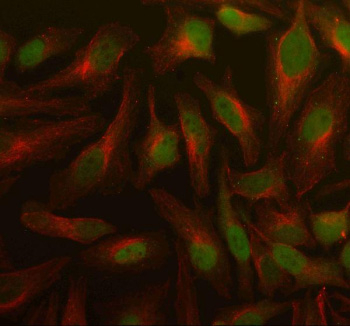 Immunofluorescent staining of PSMD5 using anti-PSMD5 antibody (green) and anti-Beta Tubulin antibody (red). PSMD5 was detected in an immunocytochemical section of Hela cells. Enzyme antigen retrieval was performed using IHC enzyme antigen retrieval reagent for 15 mins. The cells were blocked with 10% goat serum. And then incubated with 5 ug/ml rabbit anti-PSMD5 antibody and mouse anti-Beta Tubulin antibody overnight at 4oC. DyLight 488 Conjugated Goat Anti-Rabbit IgG and Cy3 Conjugated Goat Anti-Mouse IgG were used as secondary antibody at 1:500 dilution and incubated for 30 minutes at 37oC. Visualize using a fluorescence microscope and filter sets appropriate for the label used.