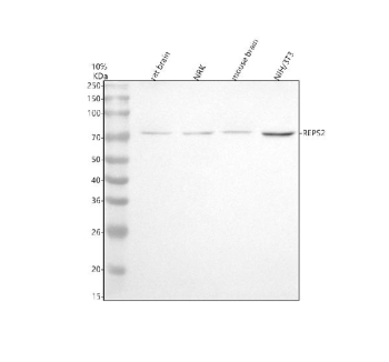 Western blot analysis of REPS2 using anti-REPS2 antibody. Electrophoresis was performed on a 10% SDS-PAGE gel at 80V (Stacking gel) / 120V (Resolving gel) for 2 hours. Lane 1: rat brain tissue lysates, Lane 2: rat NRK whole cell lysates, Lane 3: mouse brain tissue lysates, Lane 4: mouse NIH/3T3 whole cell lysates. After electrophoresis, proteins were transferred to a nitrocellulose membrane at 150 mA for 50-90 minutes. Blocked the membrane with 5% non-fat milk/TBS for 1.5 hour at RT. The membrane was incubated with rabbit anti-REPS2 antibody at 0.5 ug/ml overnight at 4oC, then washed with TBS-0.1%Tween 3 times with 5 minutes each and probed with a goat anti-rabbit IgG-HRP secondary antibody at a dilution of 1:5000 for 1.5 hour at RT. The signal was developed using an ECL Plus Western Blotting Substrate. A specific band was detected for REPS2 at approximately 72 kDa. The expected molecular weight of REPS2 is ~72 kDa.