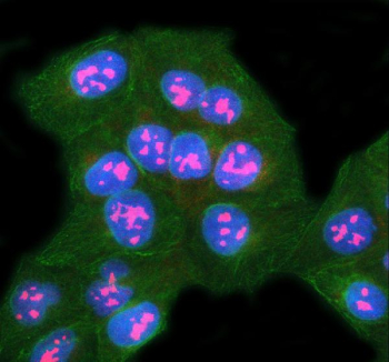 Immunofluorescent staining of SURF6 using anti-SURF6 antibody (red) and anti-Beta Tubulin antibody (green). SURF6 was detected in immunocytochemical section of U2OS cell. Enzyme antigen retrieval was performed using IHC enzyme antigen retrieval reagent for 15 mins. The cells were blocked with 10% goat serum. And then incubated with 5 ug/ml rabbit anti-SURF6 antibody and mouse anti-Beta Tubulin antibody overnight at 4oC. Cy3 Conjugated Goat Anti-Rabbit IgG and FITC Conjugated Goat Anti-Mouse IgG were used as secondary antibody at 1:500 dilution and incubated for 30 minutes at 37oC. The section was counterstained with DAPI nuclear stain (blue). Visualize using a fluorescence microscope and filter sets appropriate for the label used.