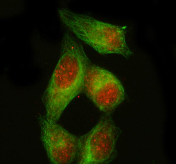 Immunofluorescent staining of PDX1 using anti-PDX1 antibody (red) and anti-Beta Tubulin antibody (green). PDX1 was detected in immunocytochemical section of HELA cell. Enzyme antigen retrieval was performed using IHC enzyme antigen retrieval reagent for 15 mins. The cells were blocked with 10% goat serum. And then incubated with 5 ug/ml rabbit anti-PDX1 antibody and mouse anti-Beta Tubulin antibody overnight at 4oC. Cy3 Conjugated Goat Anti-Rabbit IgG and FITC Conjugated Goat Anti-Mouse IgG were used as secondary antibody at 1:500 dilution and incubated for 30 minutes at 37oC. Visualize using a fluorescence microscope and filter sets appropriate for the label used.
