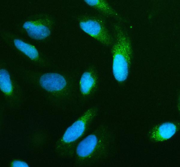 Immunofluorescent staining of BNIP3L using anti-BNIP3L antibody (green). BNIP3L was detected in an immunocytochemical section of U2OS cells. Enzyme antigen retrieval was performed using IHC enzyme antigen retrieval reagent for 15 mins. The cells were blocked with 10% goat serum. And then incubated with 5 ug/ml rabbit anti-BNIP3L antibody overnight at 4oC. DyLight 488 Conjugated Goat Anti-Rabbit IgG was used as secondary antibody at 1:500 dilution and incubated for 30 minutes at 37oC. The section was counterstained with DAPI nuclear stain (blue). Visualize using a fluorescence microscope and filter sets appropriate for the label used.