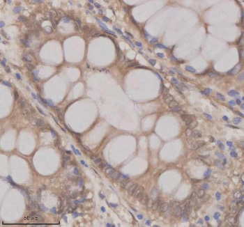 Immunohistochemical staining of OAZ1 using anti-OAZ1 antibody. OAZ1 was detected in a paraffin-embedded section of human colon tissue. Heat mediated antigen retrieval was performed in EDTA buffer (pH 8.0, epitope retrieval solution). The tissue section was blocked with 10% goat serum. The tissue section was then incubated with 2 ug/ml rabbit anti-OAZ1 antibody overnight at 4oC. Peroxidase Conjugated Goat Anti-rabbit IgG was used as secondary antibody and incubated for 30 minutes at 37oC. The tissue section was developed using an HRP secondary and DAB substrate.