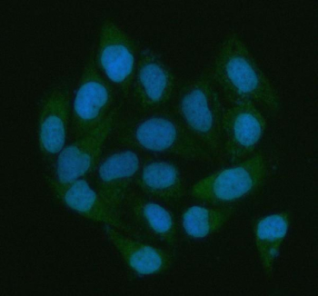 Immunofluorescent staining of LGALS3BP using anti-LGALS3BP antibody (green). LGALS3BP was detected in an immunocytochemical section of HELA cells. Enzyme antigen retrieval was performed using IHC enzyme antigen retrieval reagent for 15 mins. The cells were blocked with 10% goat serum. And then incubated with 5 ug/ml rabbit anti-LGALS3BP antibody overnight at 4oC. DyLight 488 Conjugated Goat Anti-Rabbit IgG was used as secondary antibody at 1:500 dilution and incubated for 30 minutes at 37oC. The section was counterstained with DAPI nuclear stain (blue). Visualize using a fluorescence microscope and filter sets appropriate for the label used.