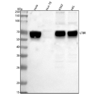 Ltbr Signaling LTBR Antibody | Lymphotoxin-beta receptor | FY13221