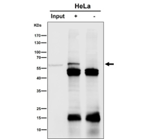 Immunoprecipitation analysis using the antibody at 1:50 dilution. Western blot at 1:1000 dilution. Immunoprecipitation of SLC27A4 (FATP4) from HeLa lysate followed by Western blot detection shows a specific band at ~60 kDa, also present in the input sample and absent in the negative control. A separate Western blot of total lysate detects the expected ~72 kDa full-length protein. SLC27A4 is not known to be glycosylated, and its predicted mass (~72 kDa) reflects the complete 643-amino-acid translation product. The lower-migrating ~60 kDa form likely represents a truncated or processed species of SLC27A4 rather than a deglycosylated variant.