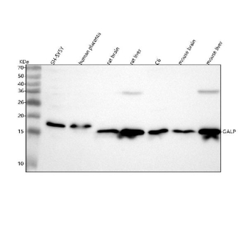 Western blot analysis of GALP using anti-GALP antibody. Lane 1: human SH-SY5Y whole cell lysates, Lane 2: human placenta tissue lysates, Lane 3: rat brain tissue lysates, Lane 4: rat liver tissue lysates, Lane 5: rat C6 whole cell lysates, Lane 6: mouse brain tissue lysates, Lane 7: mouse liver tissue lysates. After electrophoresis, proteins were transferred to a nitrocellulose membrane at 150 mA for 50-90 minutes. Blocked the membrane with 5% non-fat milk/TBS for 1.5 hour at RT. The membrane was incubated with rabbit anti-GALP antibody at 0.25 ug/ml overnight at 4oC, then washed with TBS-0.1%Tween 3 times with 5 minutes each and probed with a goat anti-rabbit IgG-HRP secondary antibody at a dilution of 1:5000 for 1.5 hour at RT. The signal was developed using enhanced chemiluminescent. Western blot detection of GALP shows a single band at ~17 kDa in human samples and ~15 kDa in mouse/rat, consistent with the small pro-peptide migrating slightly above the calculated ~13 kDa. An additional ~36 kDa band appears in mouse/rat liver only; given the low hepatic expression of GALP, this band likely reflects non-specific reactivity or an SDS-resistant aggregate rather than authentic GALP.