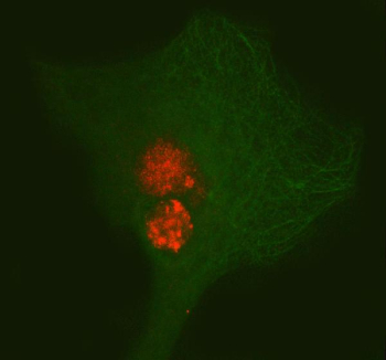 Immunofluorescent staining of PAX3 using anti-PAX3 antibody (red) and anti-Beta Tubulin antibody (green). PAX3 was detected in immunocytochemical section of cell. Enzyme antigen retrieval was performed using IHC enzyme antigen retrieval reagent for 15 mins. The cells were blocked with 10% goat serum. And then incubated with 5 ug/ml rabbit anti-PAX3 antibody and mouse anti-Beta Tubulin antibody overnight at 4oC. Cy3 Conjugated Goat Anti-Rabbit IgG and DyLight 488 Conjugated Goat Anti-Mouse IgG were used as secondary antibody at 1:500 dilution and incubated for 30 minutes at 37oC. Visualize using a fluorescence microscope and filter sets appropriate for the label used.