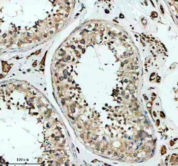Immunohistochemical staining of SKA3 using anti-SKA3 antibody. SKA3 was detected in a paraffin-embedded section of human testis tissue. Heat mediated antigen retrieval was performed in EDTA buffer (pH 8.0, epitope retrieval solution). The tissue section was blocked with 10% goat serum. The tissue section was then incubated with 2 ug/ml rabbit anti-SKA3 antibody overnight at 4oC. Peroxidase Conjugated Goat Anti-rabbit IgG was used as secondary antibody and incubated for 30 minutes at 37oC. The tissue section was developed using an HRP secondary and DAB substrate.