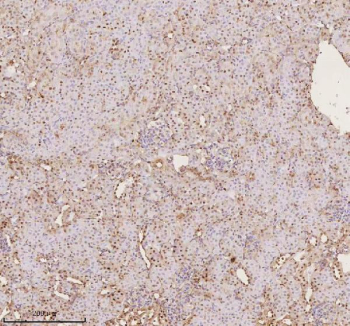 Immunohistochemical staining of PTRHD1 using anti-PTRHD1 antibody. PTRHD1 was detected in a paraffin-embedded section of mouse kidney tissue. Heat mediated antigen retrieval was performed in EDTA buffer (pH 8.0, epitope retrieval solution). The tissue section was blocked with 10% goat serum. The tissue section was then incubated with 2 ug/ml rabbit anti-PTRHD1 antibody overnight at 4oC. Peroxidase Conjugated Goat Anti-rabbit IgG was used as secondary antibody and incubated for 30 minutes at 37oC. The tissue section was developed using an HRP secondary and DAB substrate.