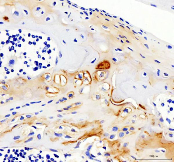 Immunohistochemical staining of Collagen Type II/COL2A1 using anti-COL2A1 antibody. Collagen Type II/COL2A1 was detected in a paraffin-embedded section of mouse knee cartilage tissue. Heat mediated antigen retrieval was performed in EDTA buffer (pH 8.0, epitope retrieval solution). The tissue section was blocked with 10% goat serum. The tissue section was then incubated with 2 ug/ml rabbit anti-COL2A1 antibody overnight at 4oC. Peroxidase Conjugated Goat Anti-rabbit IgG was used as secondary antibody and incubated for 30 minutes at 37oC. The tissue section was developed using an HRP secondary and DAB substrate.