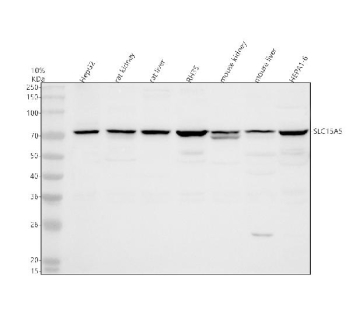 Western blot analysis of SLC15A5 using anti-SLC15A5 antibody. Electrophoresis was performed on a 10% SDS-PAGE gel at 80V (Stacking gel) / 120V (Resolving gel) for 2 hours. Lane 1: human HepG2 whole cell lysates, Lane 2: rat kidney tissue lysates, Lane 3: rat liver tissue lysates, Lane 4: rat RH35 whole cell lysates, Lane 5: rat kidney tissue lysates, Lane 6: mouse liver tissue lysates, Lane 7: mouse HEPA1-6 whole cell lysates. After electrophoresis, proteins were transferred to a nitrocellulose membrane at 150 mA for 50-90 minutes. Blocked the membrane with 5% non-fat milk/TBS for 1.5 hour at RT. The membrane was incubated with rabbit anti-SLC15A5 antibody at 0.5 ug/ml overnight at 4oC, then washed with TBS-0.1%Tween 3 times with 5 minutes each and probed with a goat anti-rabbit IgG-HRP secondary antibody at a dilution of 1:5000 for 1.5 hour at RT. The signal was developed using an ECL Plus Western Blotting Substrate. A predominant band is detected at an approximately 70 kDa in all samples, running slightly above the predicted ~65 kDa size of the 579 amino acid SLC15A5 polypeptide, consistent with the higher apparent molecular weight expected for a glycosylated multi-pass membrane transporter.