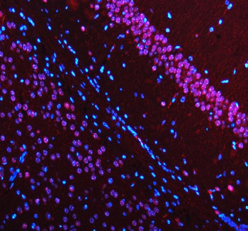 Immunofluorescent staining of MECP2 using anti-MECP2 antibody (red). MECP2 was detected in a paraffin-embedded section of mouse brain tissue. Heat mediated antigen retrieval was performed in EDTA buffer (pH 8.0, epitope retrieval solution). The tissue section was blocked with 10% goat serum. The tissue section was then incubated with 5 ug/ml rabbit anti-MECP2 antibody overnight at 4oC. Cy3 Conjugated Goat Anti-Rabbit IgG was used as secondary antibody at 1:500 dilution and incubated for 30 minutes at 37oC. The section was counterstained with DAPI nuclear stain (blue). Visualize using a fluorescence microscope and filter sets appropriate for the label used.