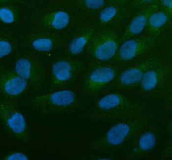 Immunofluorescent staining of ALOX5AP using anti-ALOX5AP antibody (green). ALOX5AP was detected in an immunocytochemical section of U2OS cells. Enzyme antigen retrieval was performed using IHC enzyme antigen retrieval reagent for 15 mins. The cells were blocked with 10% goat serum. And then incubated with 5 ug/ml rabbit anti-ALOX5AP antibody overnight at 4oC. DyLight 488 Conjugated Goat Anti-Rabbit IgG was used as secondary antibody at 1:500 dilution and incubated for 30 minutes at 37oC. The section was counterstained with DAPI nuclear stain (blue). Visualize using a fluorescence microscope and filter sets appropriate for the label used.