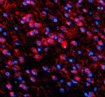 Immunofluorescent staining of TDP1 using anti-TDP1 antibody (red). TDP1 was detected in a paraffin-embedded section of mouse brain tissue. Heat mediated antigen retrieval was performed in EDTA buffer (pH 8.0, epitope retrieval solution). The tissue section was blocked with 10% goat serum. The tissue section was then incubated with 5 ug/ml rabbit anti-TDP1 antibody overnight at 4oC. Cy3 Conjugated Goat Anti-Rabbit IgG was used as secondary antibody at 1:500 dilution and incubated for 30 minutes at 37oC. The section was counterstained with DAPI nuclear stain (blue). Visualize using a fluorescence microscope and filter sets appropriate for the label used.