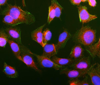 Immunofluorescent staining of GIPC1 using anti-GIPC1 antibody (red). GIPC1 was detected in an immunocytochemical section of U2OS cells. Enzyme antigen retrieval was performed using IHC enzyme antigen retrieval reagent for 15 mins. The cells were blocked with 10% goat serum. And then incubated with 5 ug/ml rabbit anti-GIPC1 antibody overnight at 4oC. DyLight 594 Conjugated Goat Anti-Rabbit IgG was used as secondary antibody at 1:100 dilution and incubated for 30 minutes at 37oC. The section was counterstained with DAPI nuclear stain (blue). The tissue section was developed using Phalloidin-iFluor 488 Conjugated (green). Visualize using a fluorescence microscope and filter sets appropriate for the label used.