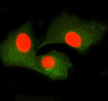 Immunofluorescent staining of SMTN using anti-SMTN antibody (red) and anti-Beta Tubulin antibody (green). SMTN was detected in immunocytochemical section of cell. Enzyme antigen retrieval was performed using IHC enzyme antigen retrieval reagent for 15 mins. The cells were blocked with 10% goat serum. And then incubated with 5 ug/ml rabbit anti-SMTN antibody and mouse anti-Beta Tubulin antibody overnight at 4oC. Cy3 Conjugated Goat Anti-Rabbit IgG and FITC Conjugated Goat Anti-Mouse IgG were used as secondary antibody at 1:500 dilution and incubated for 30 minutes at 37oC. Visualize using a fluorescence microscope and filter sets appropriate for the label used.