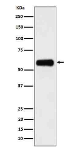 Western blot analysis of CD116 in human 293 cell lysate using CD116 antibody. A predominant band is detected at an approximately 55-60 kDa, running above the predicted ~46-47 kDa size but consistent with the higher apparent molecular weight reported for the heavily N glycosylated receptor.