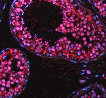 Immunofluorescent staining of TAOK2 using anti-TAOK2 antibody (red). TAOK2 was detected in a paraffin-embedded section of human testis tissue. Heat mediated antigen retrieval was performed in EDTA buffer (pH 8.0, epitope retrieval solution). The tissue section was blocked with 10% goat serum. The tissue section was then incubated with 5 ug/ml rabbit anti-TAOK2 antibody overnight at 4oC. Cy3 Conjugated Goat Anti-Rabbit IgG was used as secondary antibody at 1:500 dilution and incubated for 30 minutes at 37oC. The section was counterstained with DAPI nuclear stain (blue). Visualize using a fluorescence microscope and filter sets appropriate for the label used.