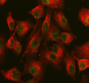 Immunofluorescent staining of NCOA6 using anti-NCOA6 antibody (green) and anti-Beta Tubulin antibody (red). NCOA6 was detected in an immunocytochemical section of cells. Enzyme antigen retrieval was performed using IHC enzyme antigen retrieval reagent for 15 mins. The cells were blocked with 10% goat serum. And then incubated with 5 ug/ml rabbit anti-NCOA6 antibody and mouse anti-Beta Tubulin antibody overnight at 4oC. DyLight 488 Conjugated Goat Anti-Rabbit IgG and DyLight?594 Conjugated Goat Anti-Mouse IgG were used as secondary antibody at 1:500 dilution and incubated for 30 minutes at 37oC. Visualize using a fluorescence microscope and filter sets appropriate for the label used.