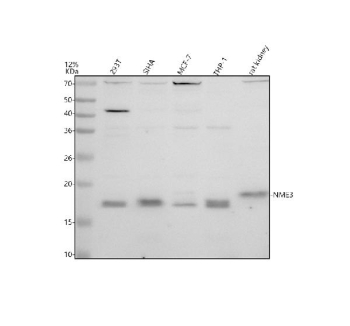 Western blot analysis of NME3 using anti-NME3 antibody. Electrophoresis was performed on a 12% SDS-PAGE gel at 80V (Stacking gel) / 120V (Resolving gel) for 2 hours. Lane 1: human 293T whole cell lysates, Lane 2: human SIHA whole cell lysates, Lane 3: human MCF-7 whole cell lysates, Lane 4: human THP-1 whole cell lysates, Lane 5: rat kidney tissue lysates. After electrophoresis, proteins were transferred to a nitrocellulose membrane at 150 mA for 50-90 minutes. Blocked the membrane with 5% non-fat milk/TBS for 1.5 hour at RT. The membrane was incubated with rabbit anti-NME3 antibody at 0.5 ug/ml overnight at 4oC, then washed with TBS-0.1%Tween 3 times with 5 minutes each and probed with a goat anti-rabbit IgG-HRP secondary antibody at a dilution of 1:5000 for 1.5 hour at RT. The signal was developed using an ECL Plus Western Blotting Substrate. A predominant band is detected at an approximately 17 kDa in human cell lines, slightly below the predicted ~19 kDa size and consistent with the processed mature form of NME3. SiHa and THP-1 lysates also show a weaker band near 18 kDa, likely representing a partially processed or differently modified NME3 species. Rat kidney displays a band close to 19 kDa, consistent with species specific differences in processing or migration.