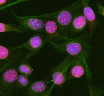 Immunofluorescent staining of RGL3 using anti-RGL3 antibody (red) and anti-Beta Tubulin antibody (green). RGL3 was detected in immunocytochemical section of human HeLa cells. Enzyme antigen retrieval was performed using IHC enzyme antigen retrieval reagent for 15 mins. The cells were blocked with 10% goat serum. And then incubated with 5 ug/ml rabbit anti-RGL3 antibody and mouse anti-Beta Tubulin antibody overnight at 4oC. Cy3 Conjugated Goat Anti-Rabbit IgG and FITC Conjugated Goat Anti-Mouse IgG were used as secondary antibody at 1:500 dilution and incubated for 30 minutes at 37oC. Visualize using a fluorescence microscope and filter sets appropriate for the label used. RGL3 shows nuclear localization in HeLa cells and cytoplasmic localization in human liver cancer tissue. Previous publicly available data suggest nucleoplasmic localization in some human cell lines (e.g., CACO-2, RT-4) and cytoplasmic in others (U-2 OS) per proteinatlas.org, but comprehensive localization across cancer types is not yet established for RGL3.