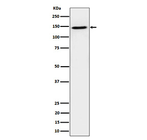 Western blot analysis of TAF3 expression in human HeLa cell lysate using TAF2 antibody. TAF3 antibody detects a strong band at ~140-150 kDa. Although the theoretical mass is ~104 kDa, TAF3 (a TFIID subunit with long acidic/disordered regions) migrates markedly slower on SDS-PAGE, and phosphorylation further increases apparent size.