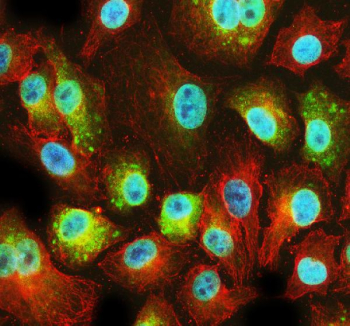 Immunofluorescent staining of PFDN2 using anti-PFDN2 antibody (green) and anti-Beta Tubulin antibody (red). PFDN2 was detected in an immunocytochemical section of cells. Enzyme antigen retrieval was performed using IHC enzyme antigen retrieval reagent for 15 mins. The cells were blocked with 10% goat serum. And then incubated with 5 ug/ml rabbit anti-PFDN2 antibody and mouse anti-Beta Tubulin antibody overnight at 4oC. DyLight 488 Conjugated Goat Anti-Rabbit IgG and Cy3 Conjugated Goat Anti-Mouse IgG were used as secondary antibody at 1:500 dilution and incubated for 30 minutes at 37oC. The section was counterstained with DAPI nuclear stain (blue). Visualize using a fluorescence microscope and filter sets appropriate for the label used.